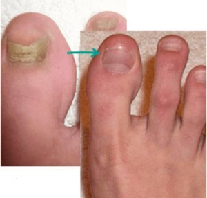 Dobre Opinie o Leku Cardio Plus - Pomoce dla Twoich Współczulnych Stawów